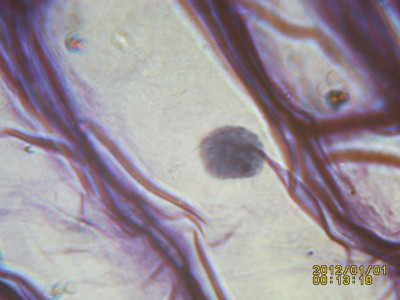 PICT0023.JPG (326.68 KiB) 18125 mal betrachtet Küchenzwiebel mit Zellkern